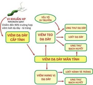viêm-dạ-dày-có-mua-được-bảo-hiểm-nhân-thọ